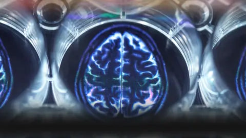 image représentant un cerveau écoutant une chanson personnalisée